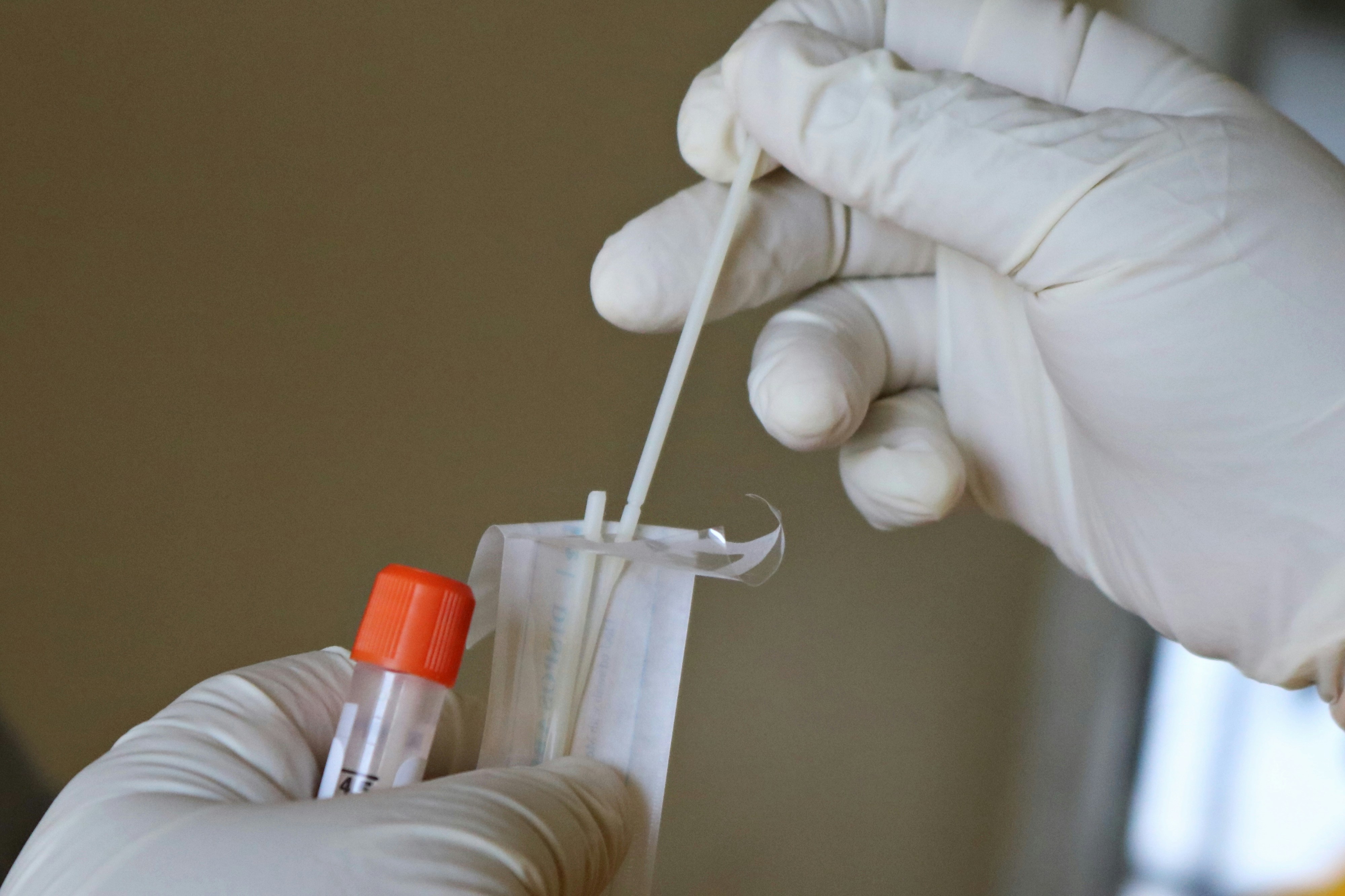 Zeldzame ziektes sneller op te sporen met nieuwe DNA-test
