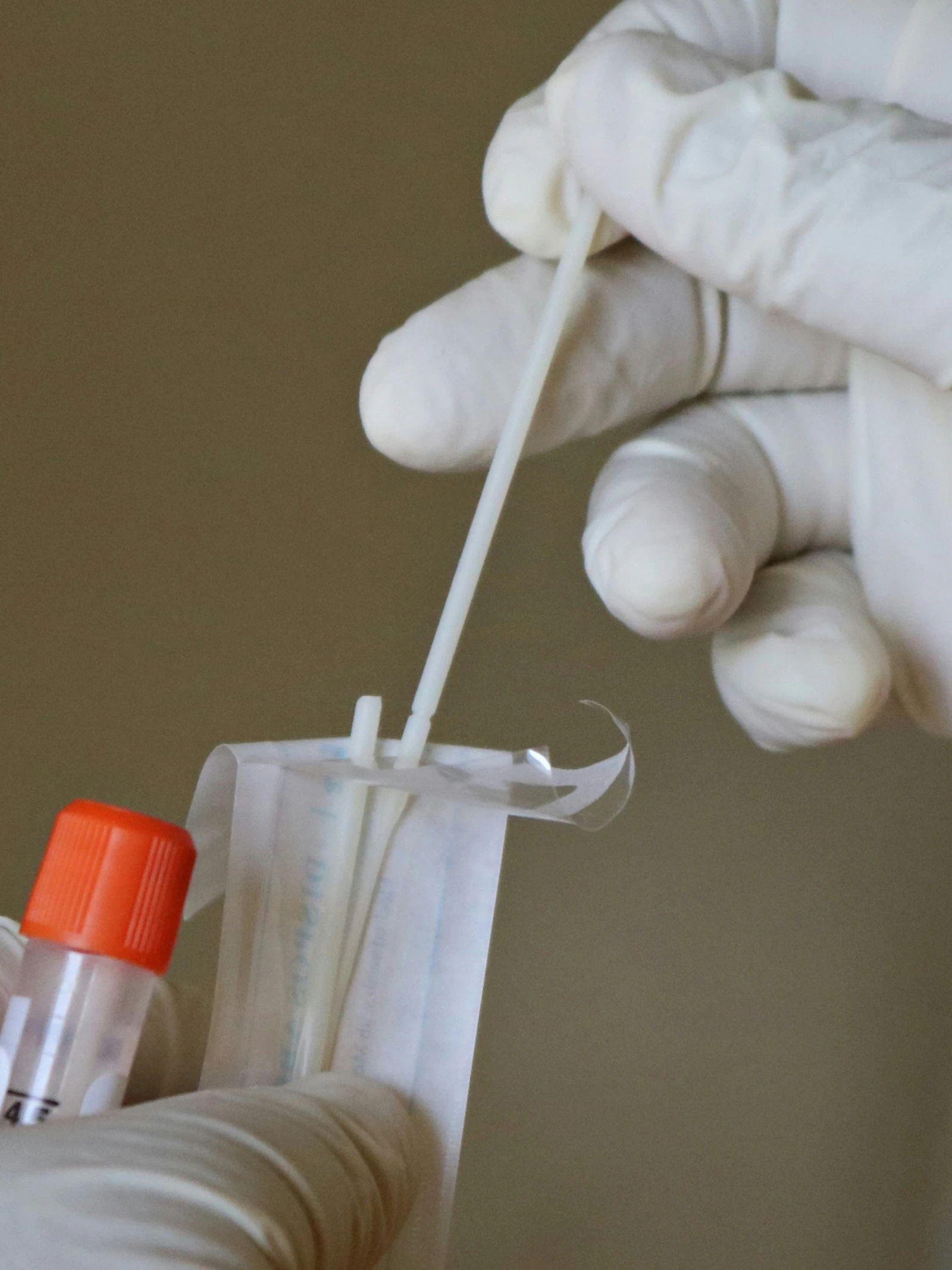 Zeldzame ziektes sneller op te sporen met nieuwe DNA-test