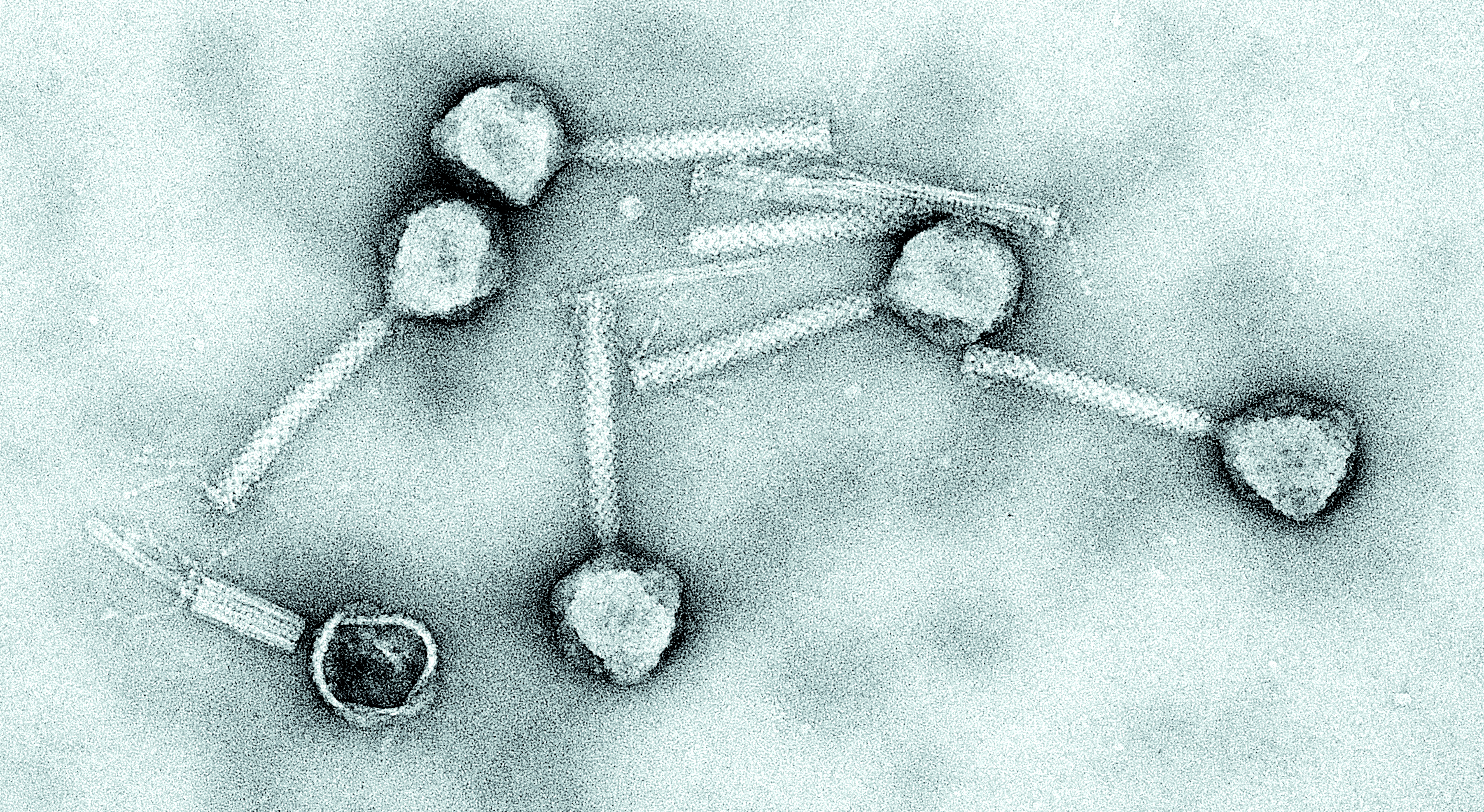 Bacteriofagen als alternatief om bacteriële infecties te bestrijden