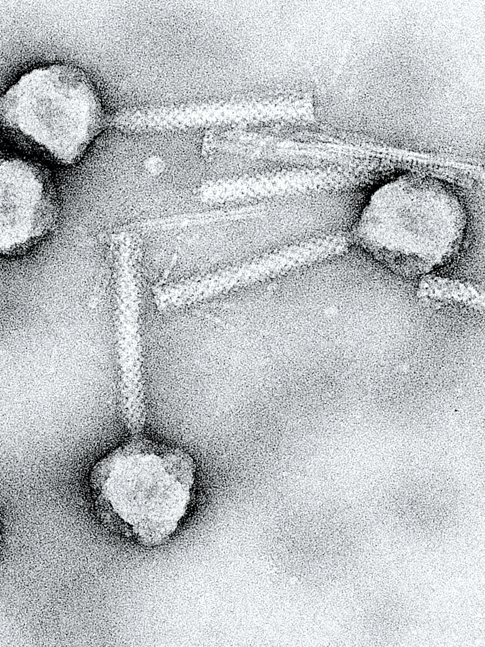 Bacteriofagen als alternatief om bacteriële infecties te bestrijden