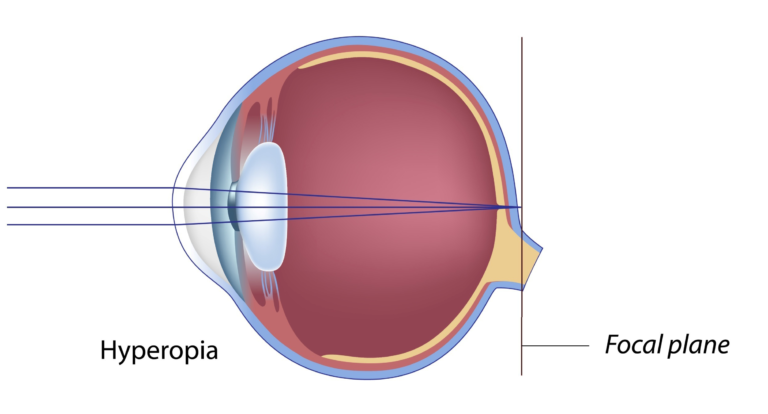 infographic of an eye
