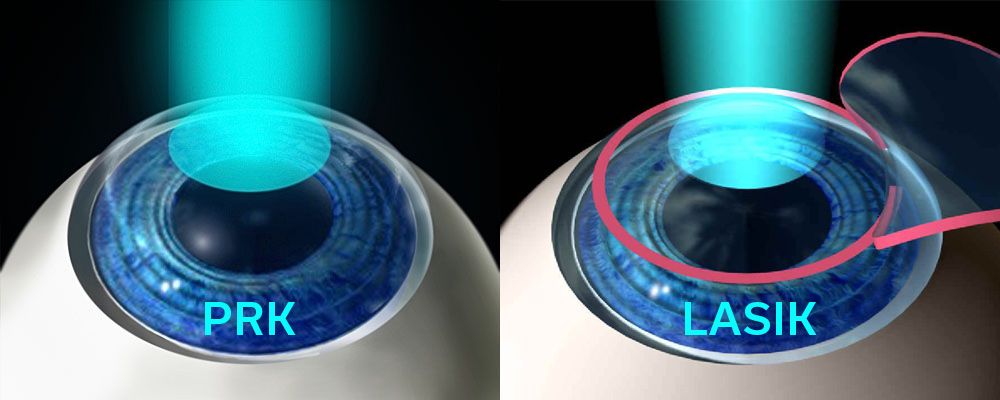eye inforgraphic