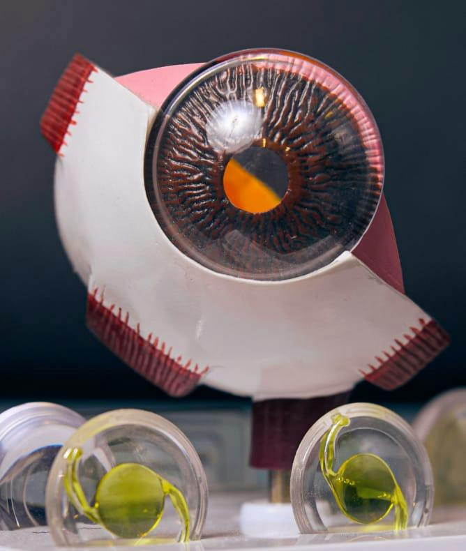 Eye model with premium intraocular lenses