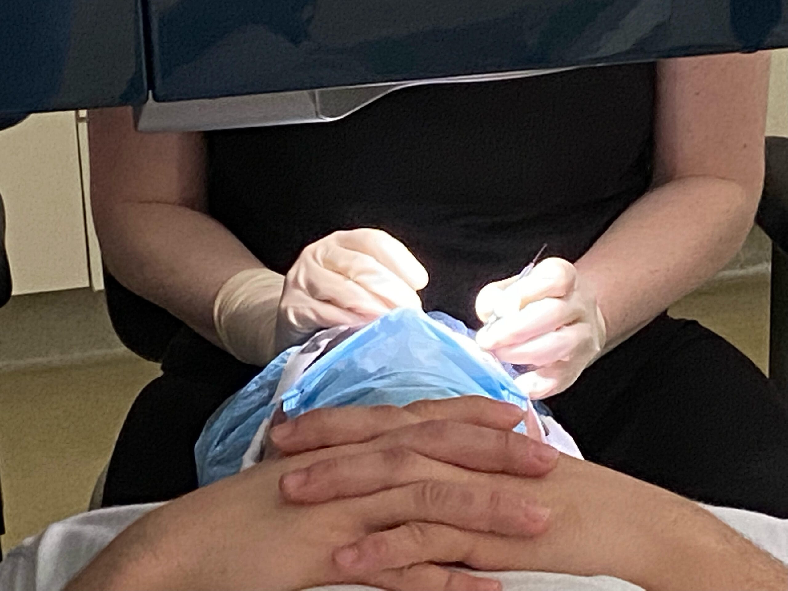 lasik surgery