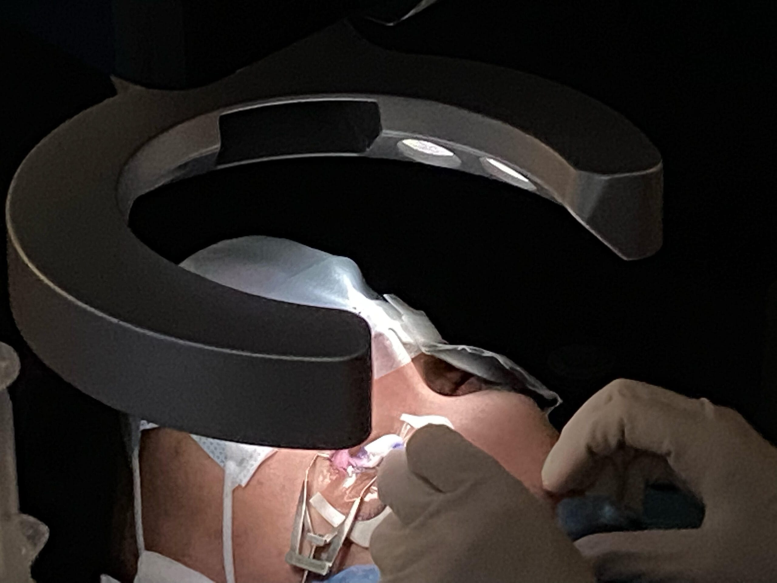 eye procedure