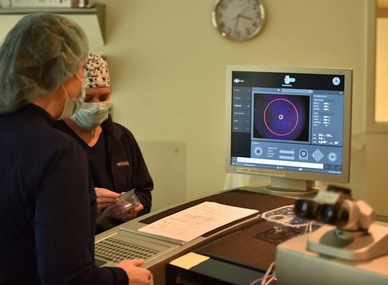 Precise cutting of the corneal flap with the FemtoSecond 200 Laser