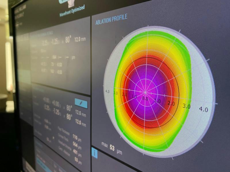 xray of an eye
