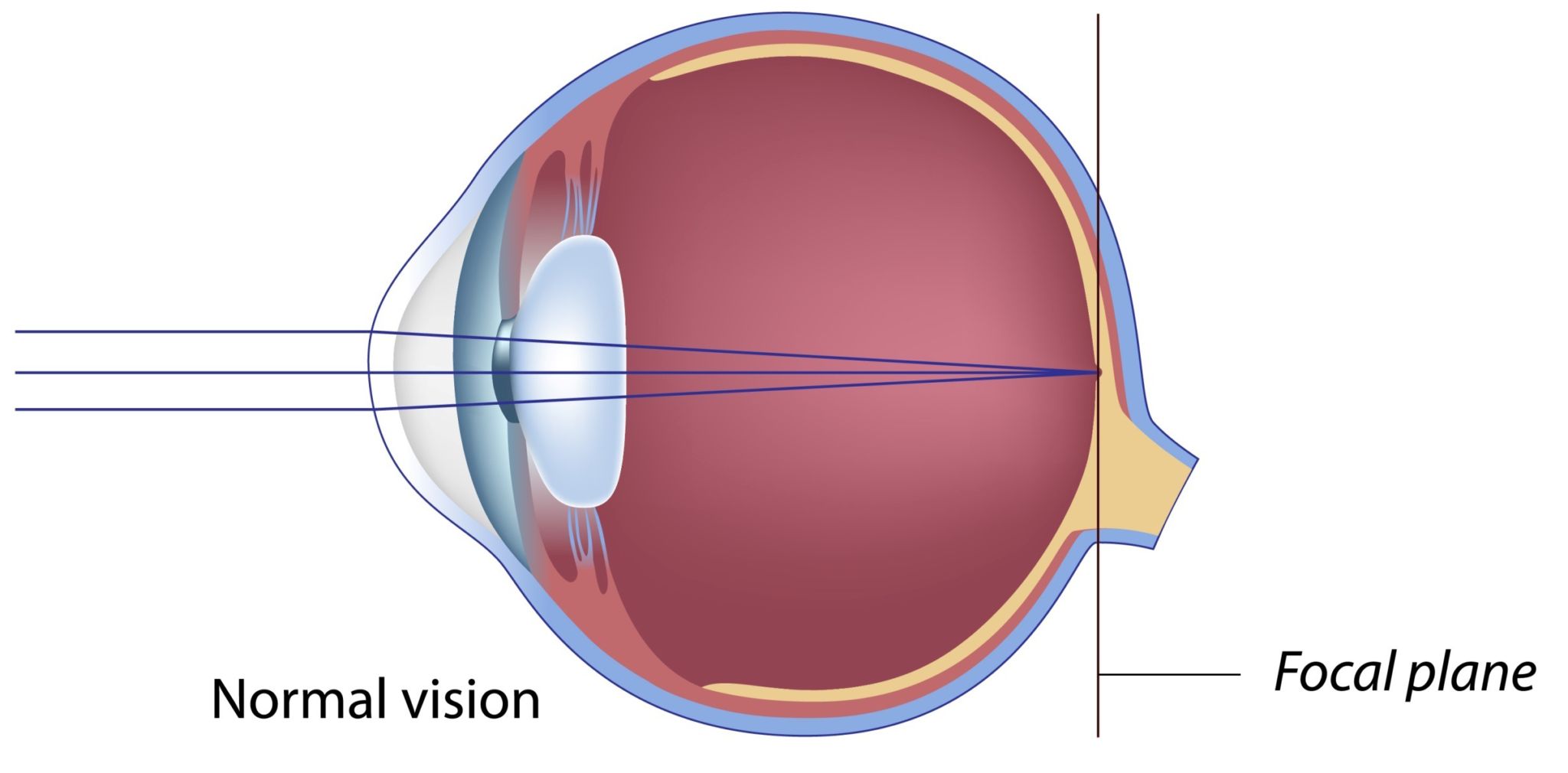 normal vision