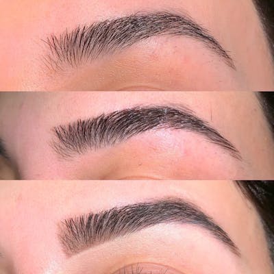 Brow Wax Before & After Gallery - Patient 3198997 - Image 1