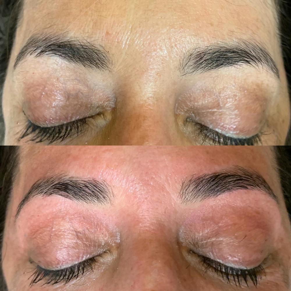 Brow Wax Before & After Gallery - Patient 3198998 - Image 1