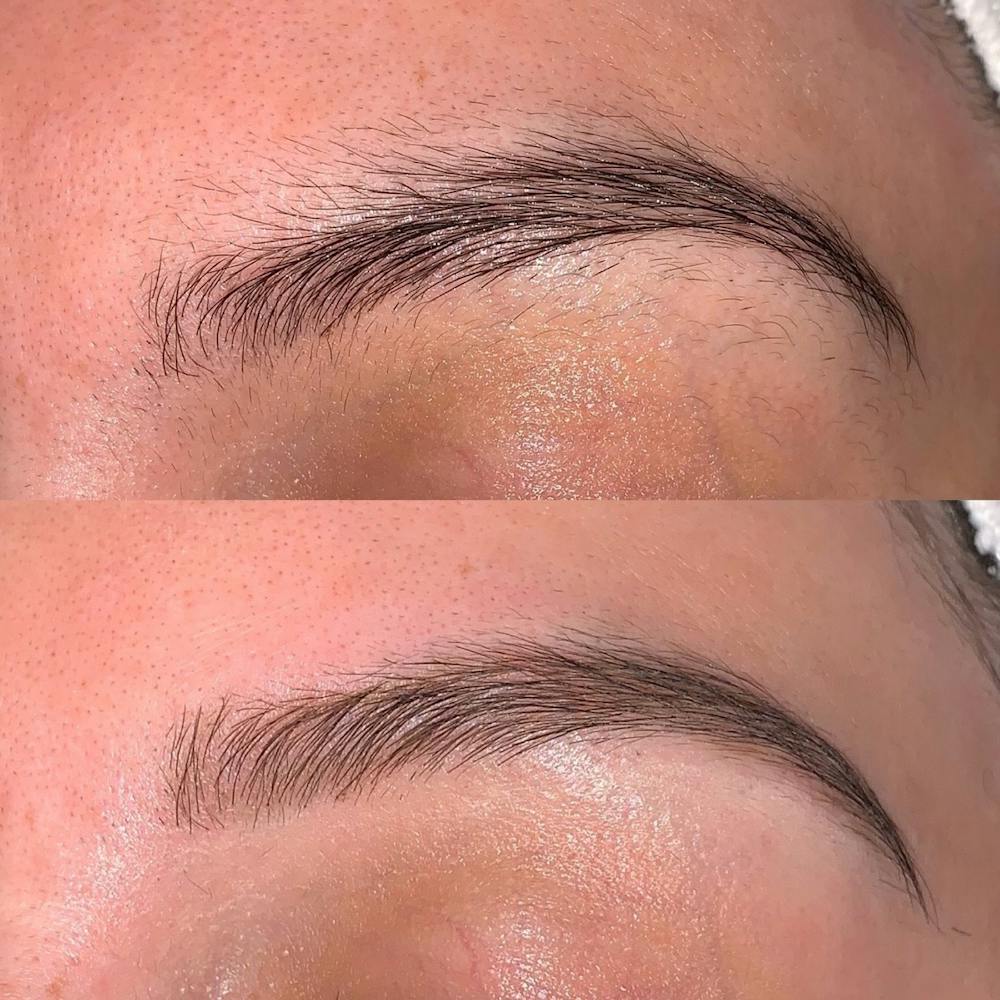Brow Wax Before & After Gallery - Patient 3198999 - Image 1