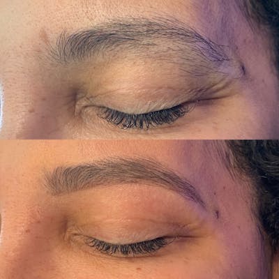 Brow Wax Before & After Gallery - Patient 3199000 - Image 1