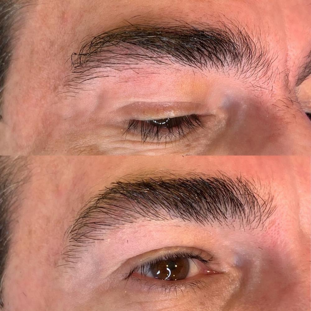 Brow Wax Before & After Gallery - Patient 3199001 - Image 1