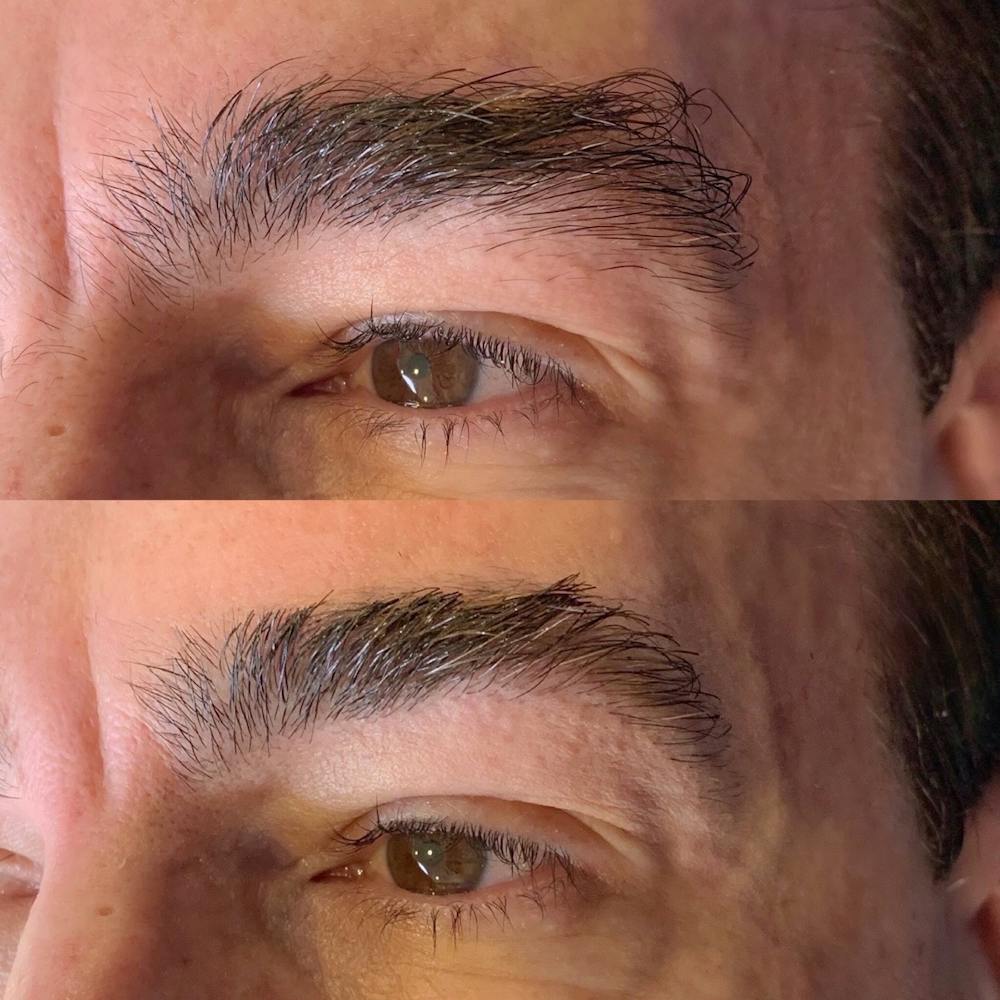 Brow Wax Before & After Gallery - Patient 3199002 - Image 1