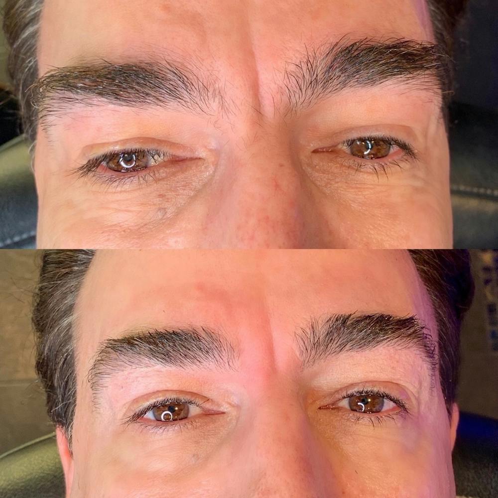 Brow Wax Before & After Gallery - Patient 3199003 - Image 1