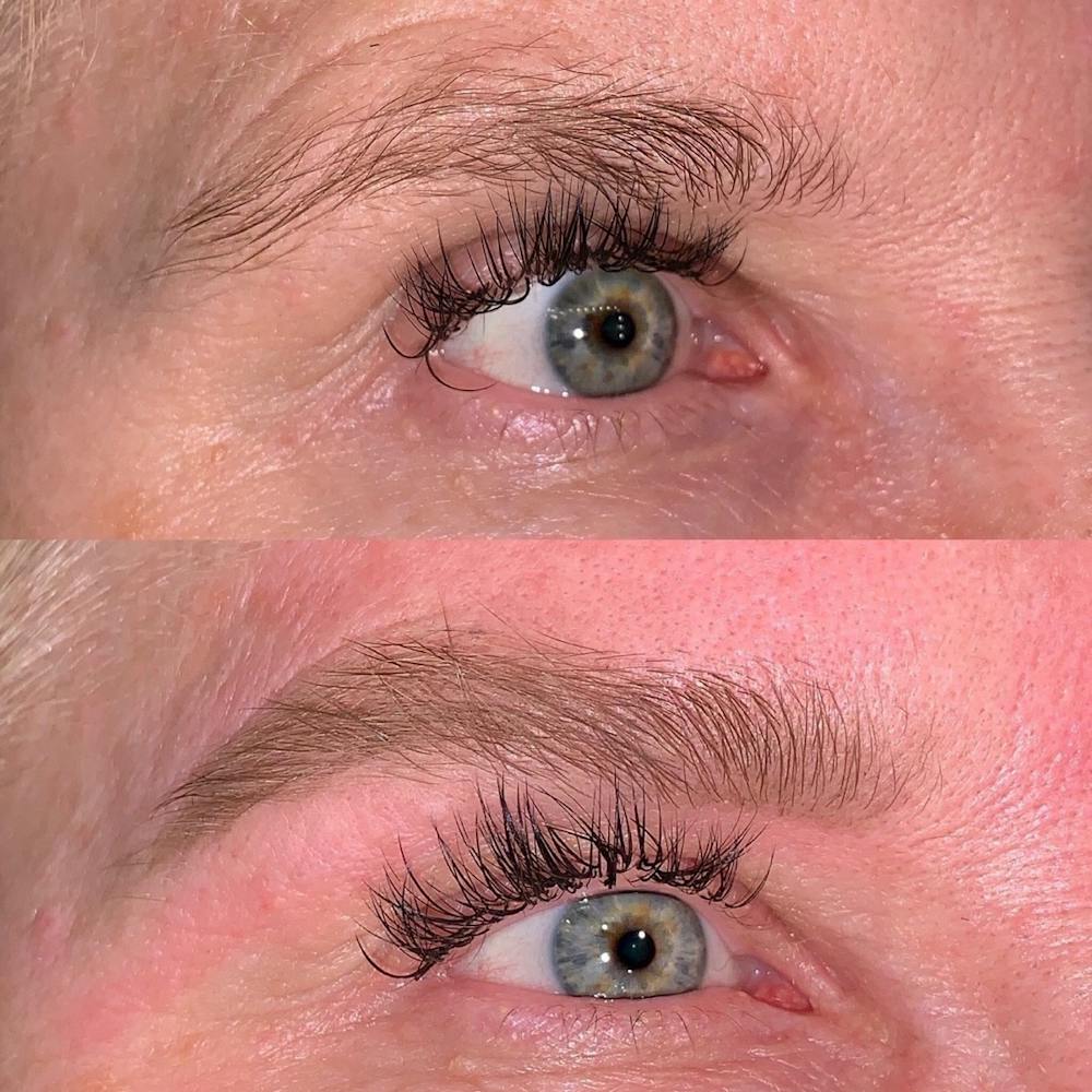 Brow Wax Before & After Gallery - Patient 3199004 - Image 1