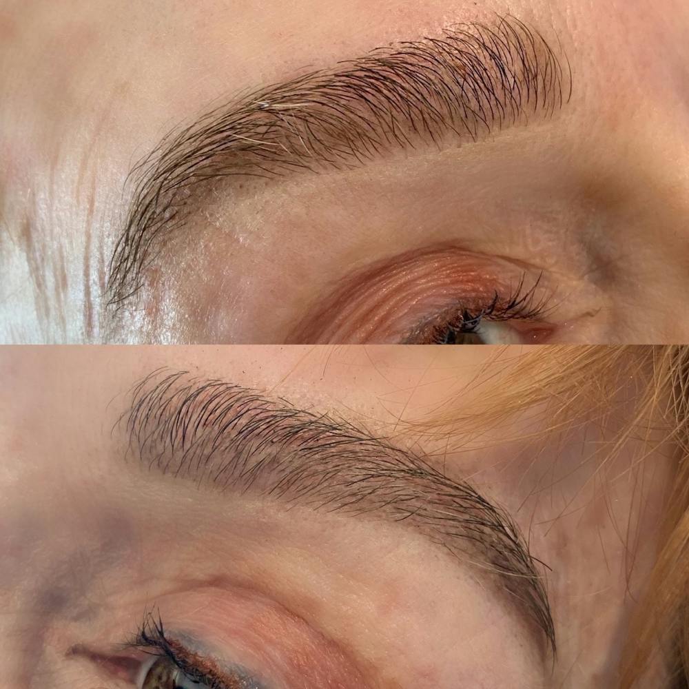 Brow Wax Before & After Gallery - Patient 3199005 - Image 1