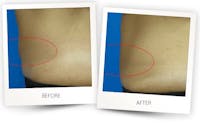 Body Before & After Gallery - Patient 3267389 - Image 1