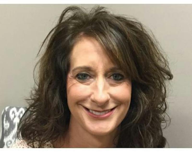 Injectables Face Before & After Gallery - Patient 429225 - Image 1