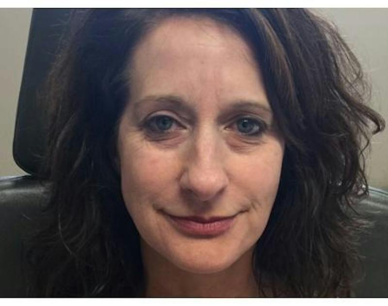 Injectables Face Before & After Gallery - Patient 429225 - Image 3