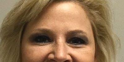 Injectables Face Before & After Gallery - Patient 144690 - Image 2