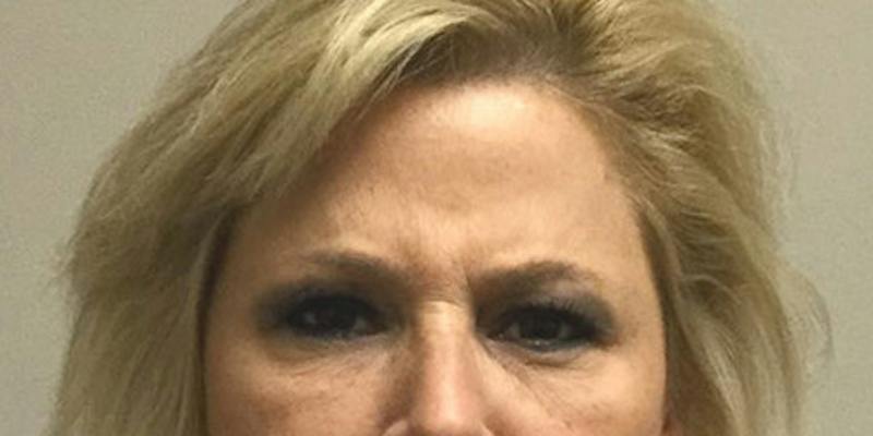 Injectables Face Before & After Gallery - Patient 144690 - Image 4