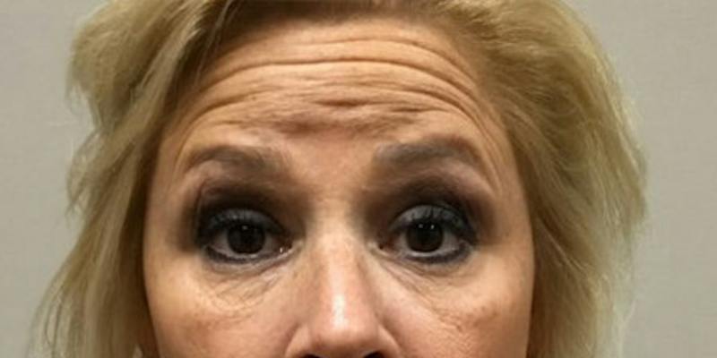Injectables Face Before & After Gallery - Patient 144690 - Image 5