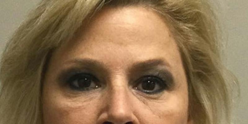 Injectables Face Before & After Gallery - Patient 144690 - Image 6