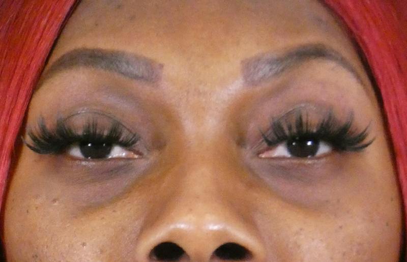 Injectables Face Before & After Gallery - Patient 636512 - Image 1