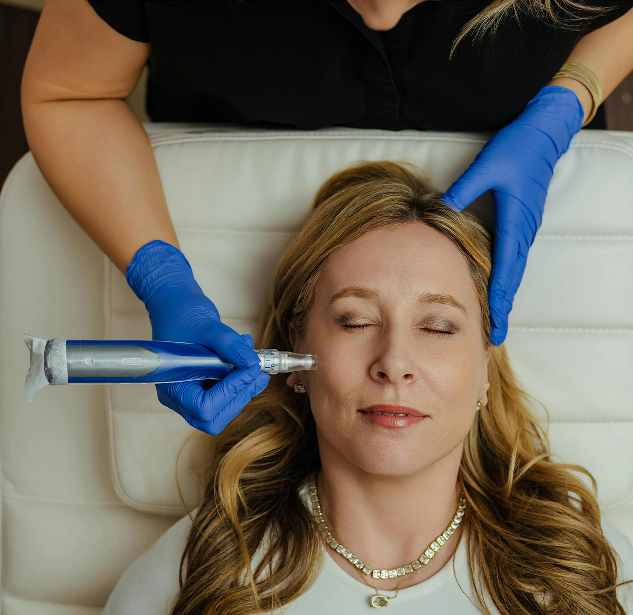 patient undergoing a microneedling procedure