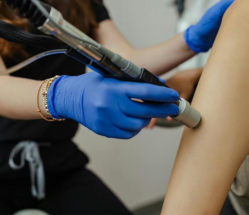 Technician in blue gloves performing laser hair removal on a client's arm