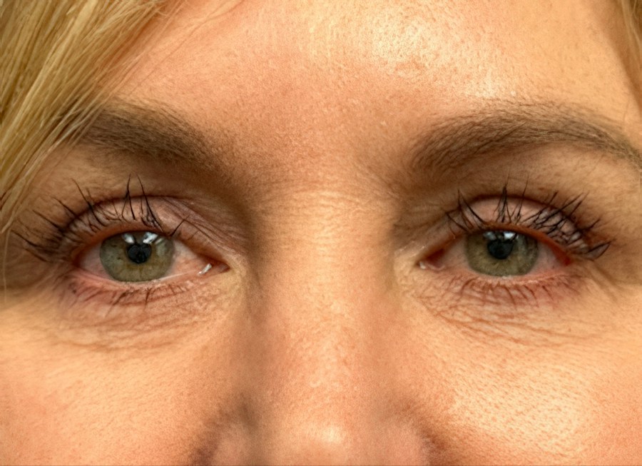 Patient 61261 | Front View | After — Dr. Tommaso Addona -