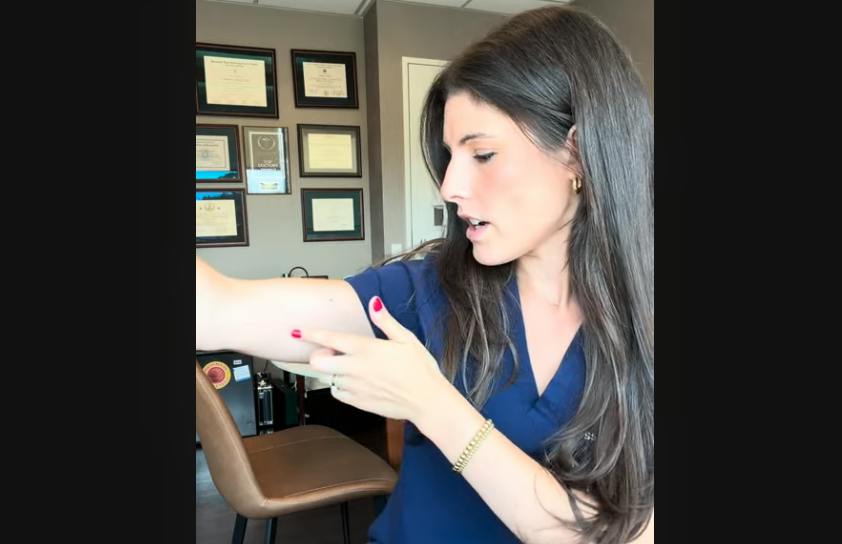 What Do Arm Lift (Brachioplasty) Scars Look Like? youtube screenshot