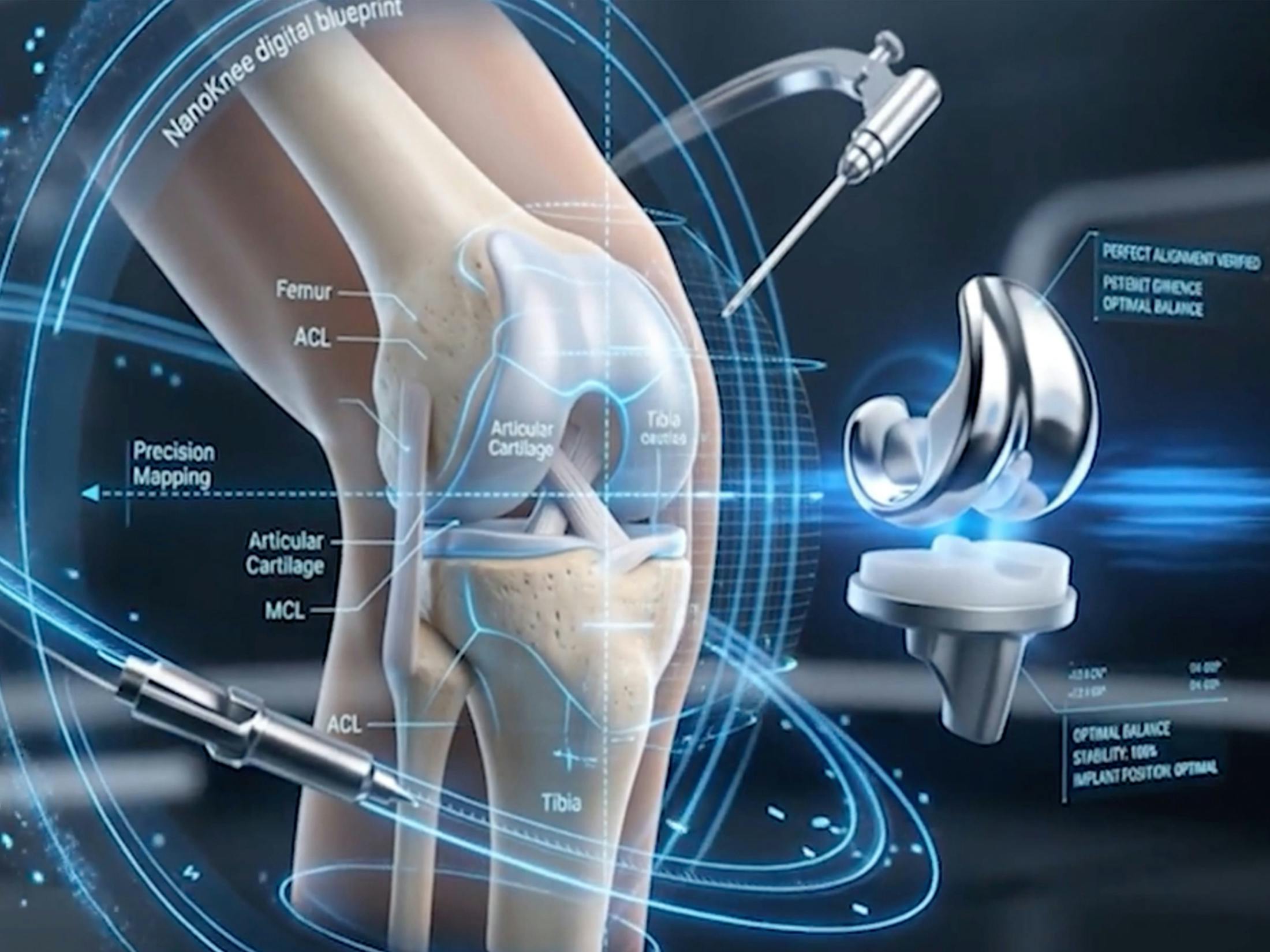 An x-ray