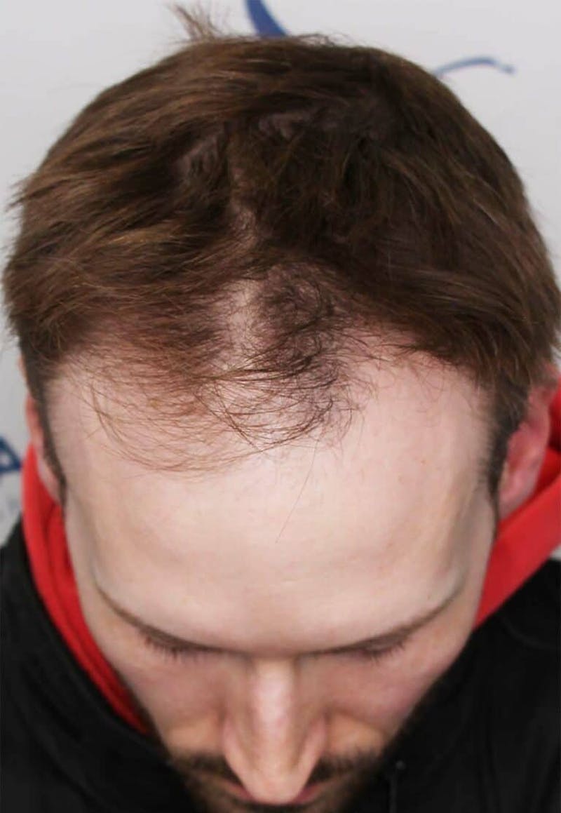 Results Before & After Gallery - Patient 319986 - Image 7