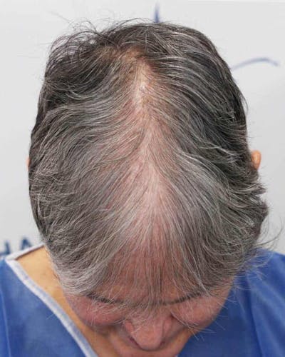 Results Before & After Gallery - Patient 362767 - Image 1