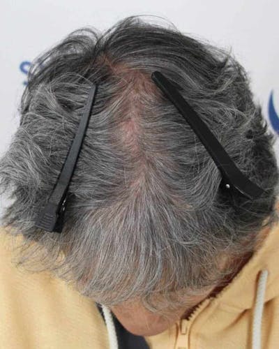 Results Before & After Gallery - Patient 362767 - Image 2