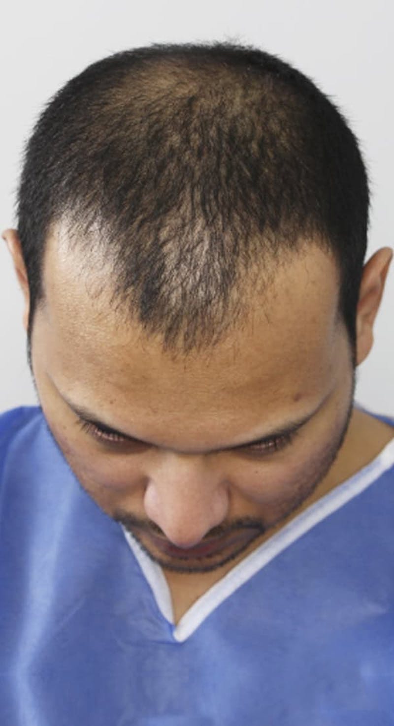 Results Before & After Gallery - Patient 486502 - Image 1