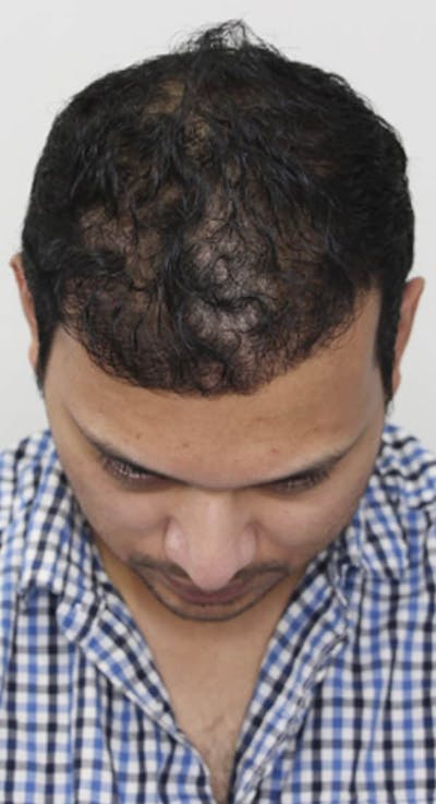 Results Before & After Gallery - Patient 486502 - Image 2