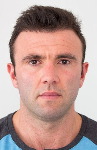 Results Before & After Gallery - Patient 111404 - Image 2