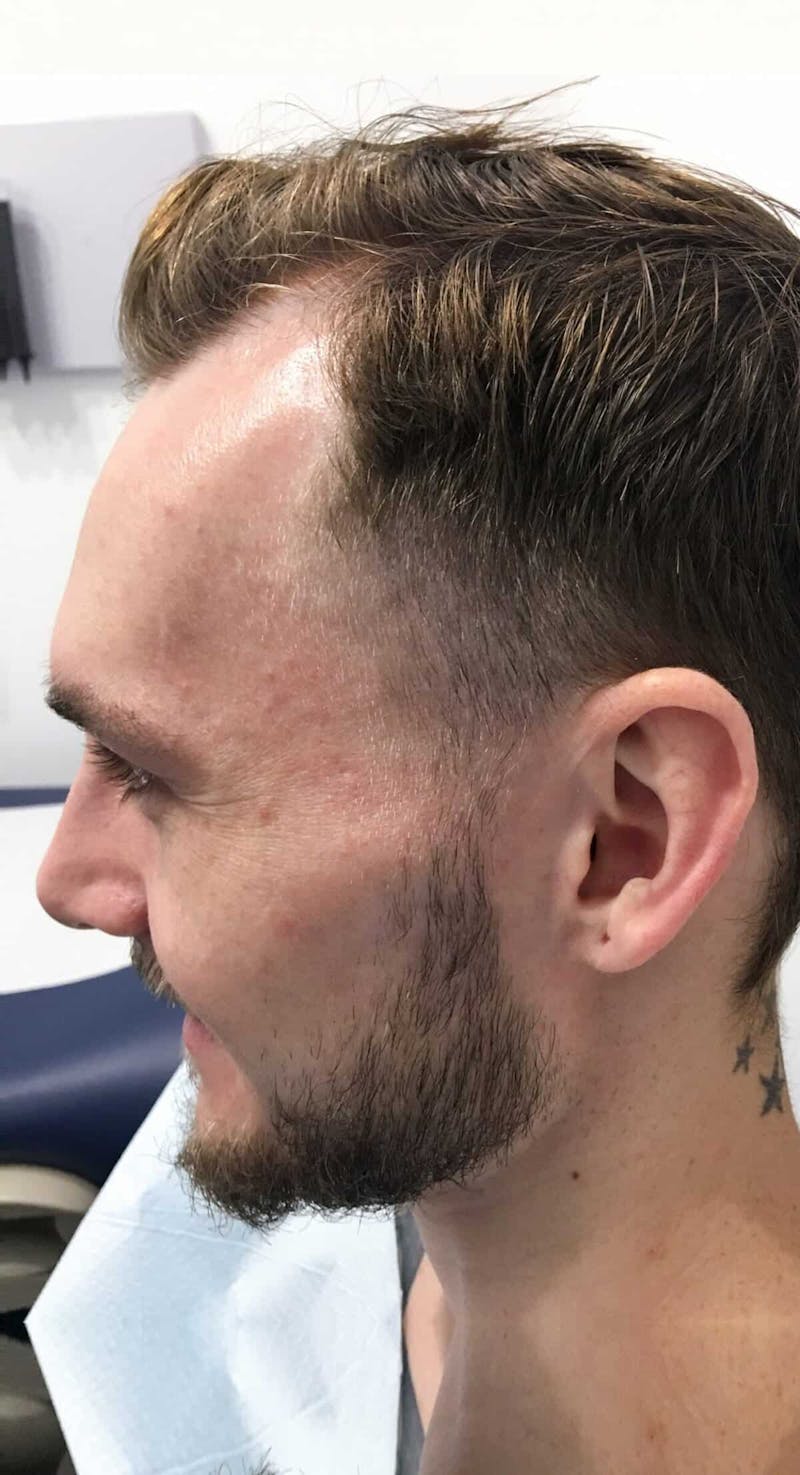 Results Before & After Gallery - Patient 288932 - Image 3