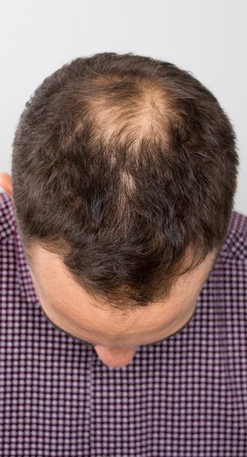 Results Before & After Gallery - Patient 135035 - Image 3
