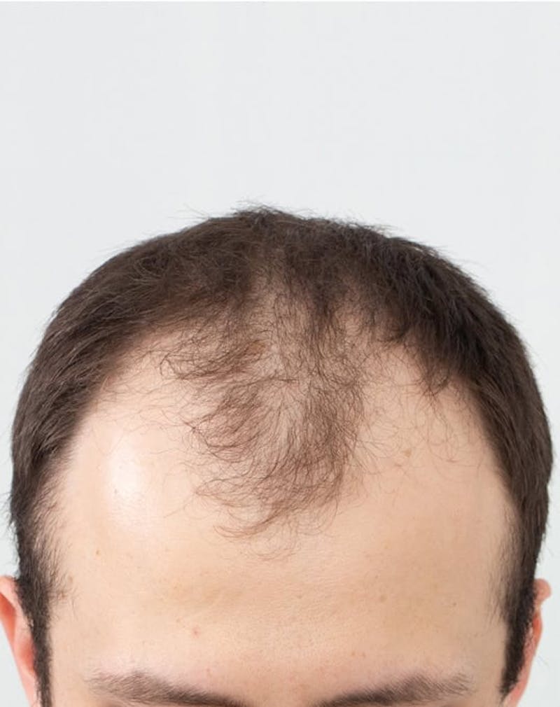 Results Before & After Gallery - Patient 181931 - Image 3
