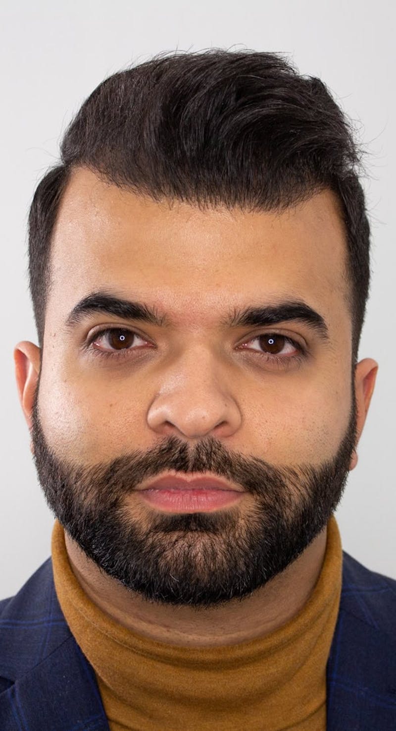 Results Before & After Gallery - Patient 374069 - Image 4
