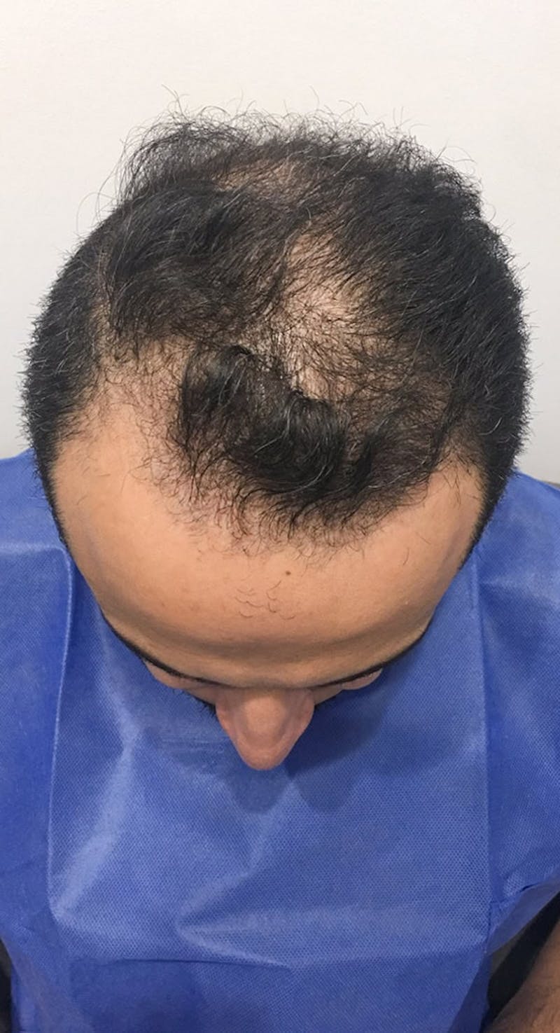 Results Before & After Gallery - Patient 416182 - Image 3