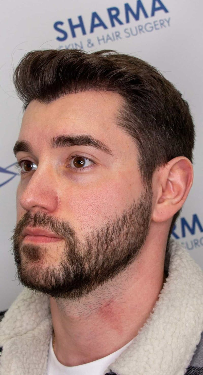 Results Before & After Gallery - Patient 281527 - Image 4