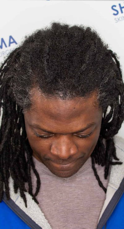 Results Before & After Gallery - Patient 521943 - Image 2