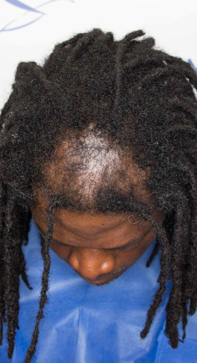 Results Before & After Gallery - Patient 521943 - Image 3