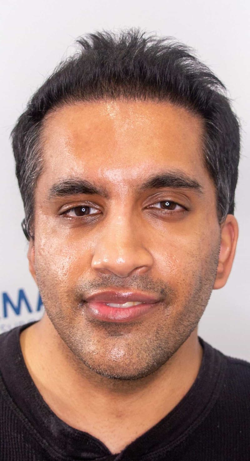 Results Before & After Gallery - Patient 175621 - Image 2