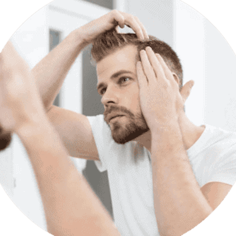man standing in a mirror examining his hairline 768x768.jpg.webp